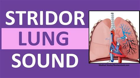 Ausmed Explains... Lung Auscultation: Adventitious Breath Sounds. 1. Stridor: Stridor is a continuous, high-pitched, crowing sound heard predominantly on ins...